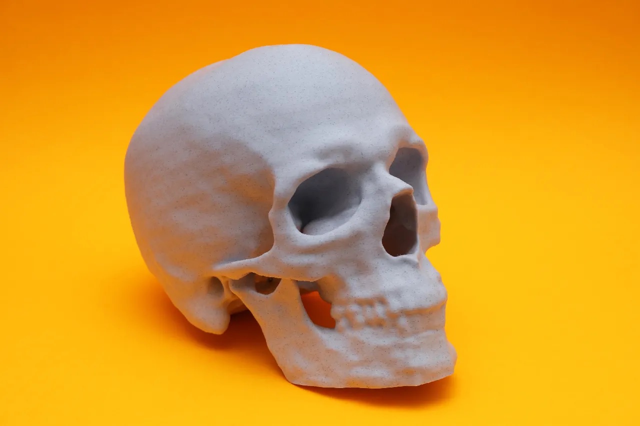 3D Printed Skull from CT Scan